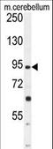 Gamma-Aminobutyric Acid Type B Receptor Subunit 2 antibody, LS-C166317, Lifespan Biosciences, Western Blot image 