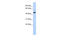 Tryptophanyl-TRNA Synthetase antibody, 27-187, ProSci, Enzyme Linked Immunosorbent Assay image 