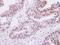 Selenophosphate Synthetase 1 antibody, LS-C185881, Lifespan Biosciences, Immunohistochemistry paraffin image 