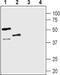 Arginine Vasopressin Receptor 1B antibody, GTX03388, GeneTex, Western Blot image 