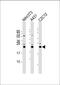 RAB7A, Member RAS Oncogene Family antibody, A02409, Boster Biological Technology, Western Blot image 