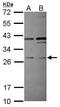 Pleckstrin Homology And FYVE Domain Containing 2 antibody, PA5-31268, Invitrogen Antibodies, Western Blot image 