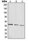Parkin RBR E3 Ubiquitin Protein Ligase antibody, MBS820747, MyBioSource, Western Blot image 