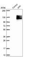 Amyloid Beta Precursor Protein antibody, HPA001462, Atlas Antibodies, Western Blot image 