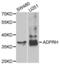 ARH1 antibody, abx004796, Abbexa, Western Blot image 