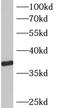 Beta-1,3-Galactosyltransferase 6 antibody, FNab00766, FineTest, Western Blot image 