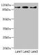 Phosphorylase Kinase Catalytic Subunit Gamma 2 antibody, LS-C676258, Lifespan Biosciences, Western Blot image 