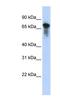 Rhophilin Rho GTPase Binding Protein 1 antibody, NBP1-55003, Novus Biologicals, Western Blot image 