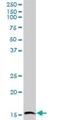 GSK3-beta interaction protein antibody, H00051527-B01P, Novus Biologicals, Western Blot image 