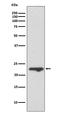 Mucin 1, Cell Surface Associated antibody, M00187-1, Boster Biological Technology, Western Blot image 