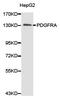 Platelet Derived Growth Factor Receptor Alpha antibody, LS-C192858, Lifespan Biosciences, Western Blot image 