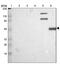 Calpain 10 antibody, PA5-52066, Invitrogen Antibodies, Western Blot image 