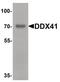 DEAD-Box Helicase 41 antibody, PA5-34550, Invitrogen Antibodies, Western Blot image 