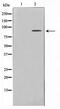 EPS8 Like 2 antibody, TA347609, Origene, Western Blot image 