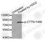 Cortactin antibody, AP0247, ABclonal Technology, Western Blot image 