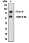 Complement Factor B antibody, LS-C354272, Lifespan Biosciences, Western Blot image 