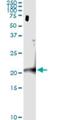 Centromere Protein M antibody, H00079019-M01, Novus Biologicals, Immunoprecipitation image 