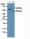 AKT Serine/Threonine Kinase 3 antibody, LS-C296106, Lifespan Biosciences, Western Blot image 