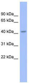 Gastrulation and brain-specific homeobox protein 2 antibody, TA330600, Origene, Western Blot image 