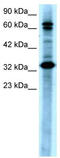 TGF-Beta Activated Kinase 1 (MAP3K7) Binding Protein 2 antibody, TA330285, Origene, Western Blot image 