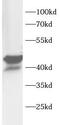 Endonuclease 8-like 1 antibody, FNab10789, FineTest, Western Blot image 