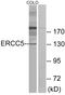 ERCC Excision Repair 5, Endonuclease antibody, LS-B9142, Lifespan Biosciences, Western Blot image 