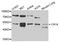 Carbonic Anhydrase 14 antibody, STJ22855, St John