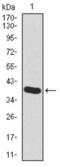 Hyaluronan Synthase 2 antibody, abx010958, Abbexa, Western Blot image 