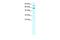 Staphylococcal Nuclease And Tudor Domain Containing 1 antibody, PA5-40562, Invitrogen Antibodies, Western Blot image 