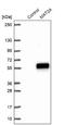 Methionine Adenosyltransferase 2A antibody, NBP1-92100, Novus Biologicals, Western Blot image 