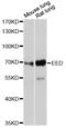 Polycomb protein EED antibody, A12776, ABclonal Technology, Western Blot image 