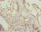 Kelch Repeat And BTB Domain Containing 7 antibody, LS-C675930, Lifespan Biosciences, Immunohistochemistry paraffin image 