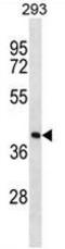 Farnesyl Diphosphate Synthase antibody, AP51646PU-N, Origene, Western Blot image 