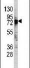 DEAD-Box Helicase 3 X-Linked antibody, PA5-11561, Invitrogen Antibodies, Western Blot image 