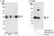 SET Nuclear Proto-Oncogene antibody, A302-262A, Bethyl Labs, Western Blot image 