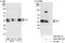 Protein SET antibody, A302-262A, Bethyl Labs, Western Blot image 