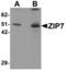 Solute Carrier Family 39 Member 7 antibody, LS-B5356, Lifespan Biosciences, Western Blot image 
