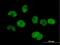 tRNA-splicing endonuclease subunit Sen34 antibody, H00079042-B01P, Novus Biologicals, Immunofluorescence image 