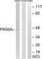 Proteasome 26S Subunit, ATPase 3 antibody, LS-C119605, Lifespan Biosciences, Western Blot image 