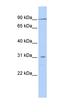 Cation Channel Sperm Associated Auxiliary Subunit Delta antibody, orb326008, Biorbyt, Western Blot image 