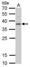 Ubiquitin Recognition Factor In ER Associated Degradation 1 antibody, NBP1-32777, Novus Biologicals, Western Blot image 
