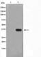 FosB Proto-Oncogene, AP-1 Transcription Factor Subunit antibody, TA325469, Origene, Western Blot image 