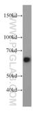 Hepatic And Glial Cell Adhesion Molecule antibody, 18177-1-AP, Proteintech Group, Western Blot image 