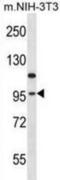 Eukaryotic Elongation Factor 2 Kinase antibody, abx028347, Abbexa, Western Blot image 
