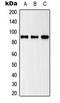Mitogen-Activated Protein Kinase Kinase Kinase 20 antibody, LS-C354181, Lifespan Biosciences, Western Blot image 
