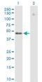 Zinc Finger Protein 776 antibody, H00284309-B01P, Novus Biologicals, Western Blot image 