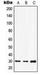 Homeobox D12 antibody, LS-B13575, Lifespan Biosciences, Western Blot image 