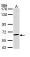 Chaperonin Containing TCP1 Subunit 5 antibody, PA5-22093, Invitrogen Antibodies, Western Blot image 