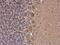 BCAR1 Scaffold Protein, Cas Family Member antibody, GTX633771, GeneTex, Immunohistochemistry paraffin image 