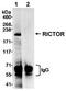 RPTOR Independent Companion Of MTOR Complex 2 antibody, ab70374, Abcam, Immunoprecipitation image 